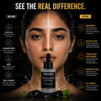 OMARO 10% Niacinamide + Salicylic Serum